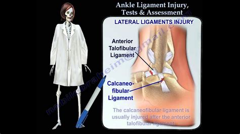 ankle ligament tear test|how to assess ankle injury.